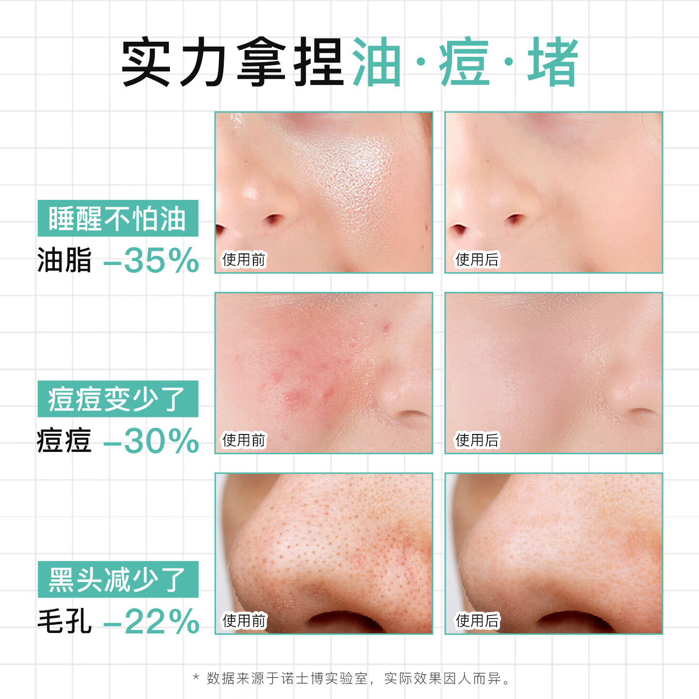 NOVEXPERT诺士博青少年专用洗面奶  祛痘去黑头控油青少年洗面奶30g 【祛痘洁面双子星】祛痘洁面30g+祛痘洁面150g