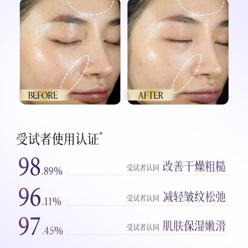 欧佩玻色因酵母弹力滋润柔肤霜50g滋润补水保湿面霜男女通用