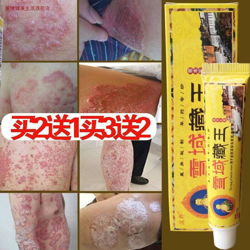 意缘家庭护理正品雪域藏王成人皮肤外用 其他/other