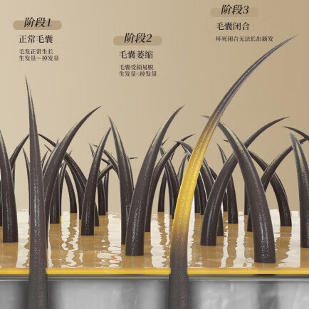 YTYU丁达育发液中药防脱育发固发养发洗发水脱发滋养强发根老姜何首乌 三瓶【发量猛涨】 300ml   