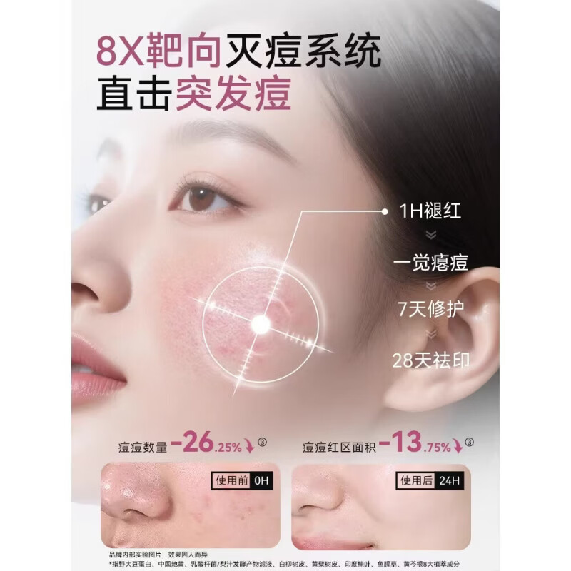 AIREE安伊妮青少年净痘乳控油修护舒缓祛痘快速祛泛红痘印小白管 15g