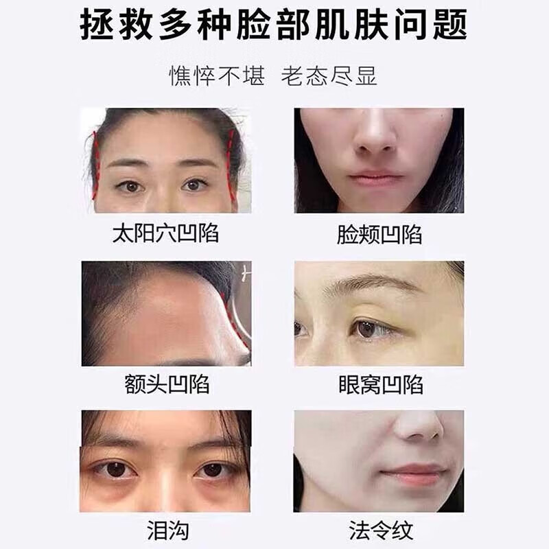 欧伯斐胶原蛋白填充粉无水配方提拉紧致抗皱淡化细纹法令纹小分子涂抹式