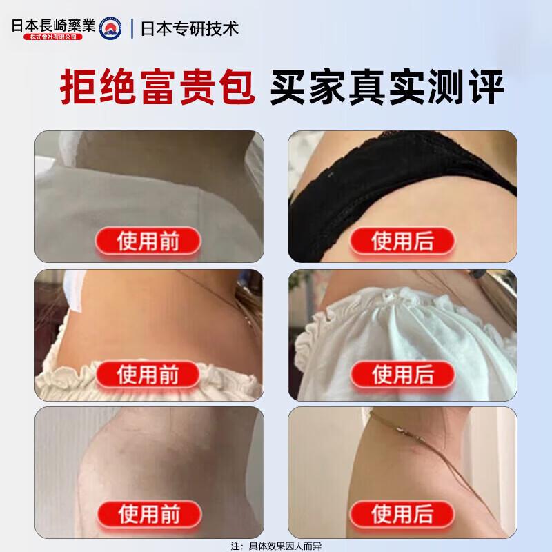 岩井昃弘富贵包消除贴颈椎疼痛治后颈鼓包专用疏通按摩矫正神器日本膏药贴 特效5盒【必除裉不再犯】 治疗富贵包日本原装进口膏贴