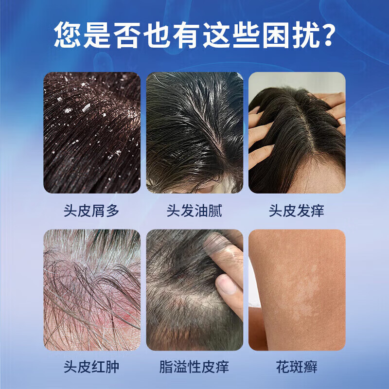 [希尔生]二硫化硒洗剂 2.5%*100g 1盒装 净屑控油止痒去头屑医用毛囊炎脂溢性皮炎花斑癣汗斑洗发水治头皮痒皮屑国药准字药 头皮屑多 头皮发痒