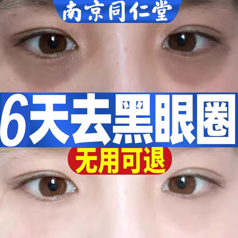 JUU家庭护理眼霜淡化黑眼圈细纹神器祛消淡化特别严重急救男 20g
