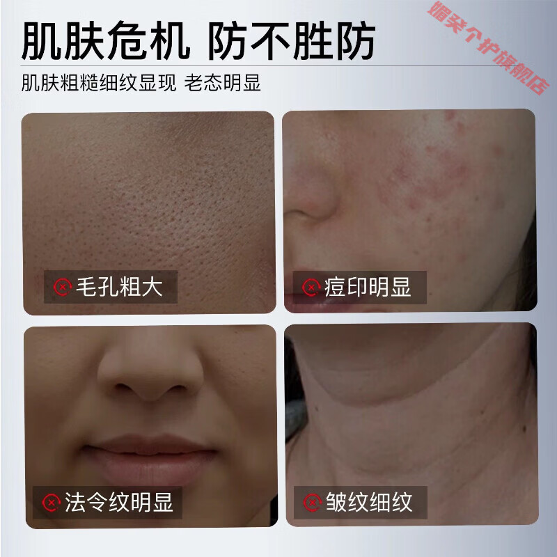 灵眷仙hsz护理膜细致毛孔淡化纹路痘印医用重组胶原蛋白凝胶敷料护理膜 1支【体验装】 【官方直售 京健保障】