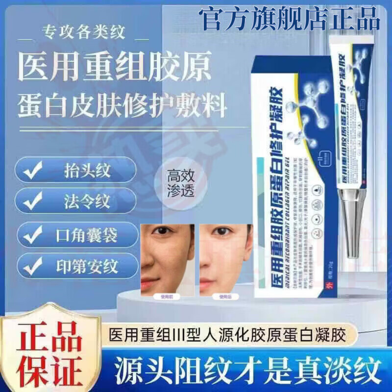 MRYU舒活宜凝胶祛法令纹颈纹医用硅酮凝胶提拉修护紧致肌肤官方旗舰店 5支装 官方自售