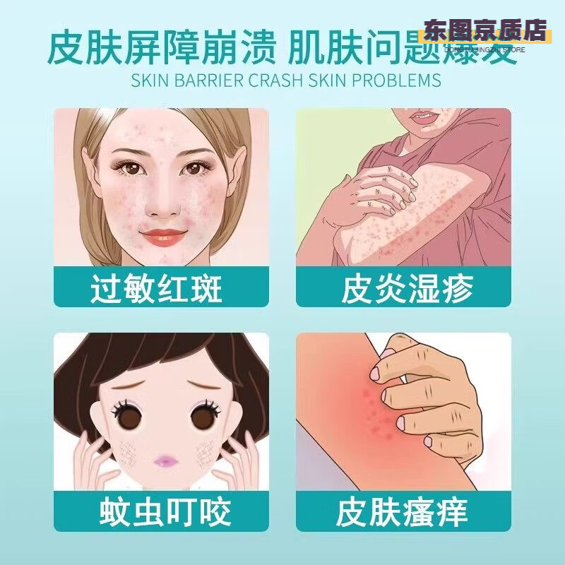 熏姿颜妙奈花皮肤湿疹止痒去外用顽固慢性皮炎抑菌膏湿痒皮肤抑菌 三盒装 官方授权旗舰店