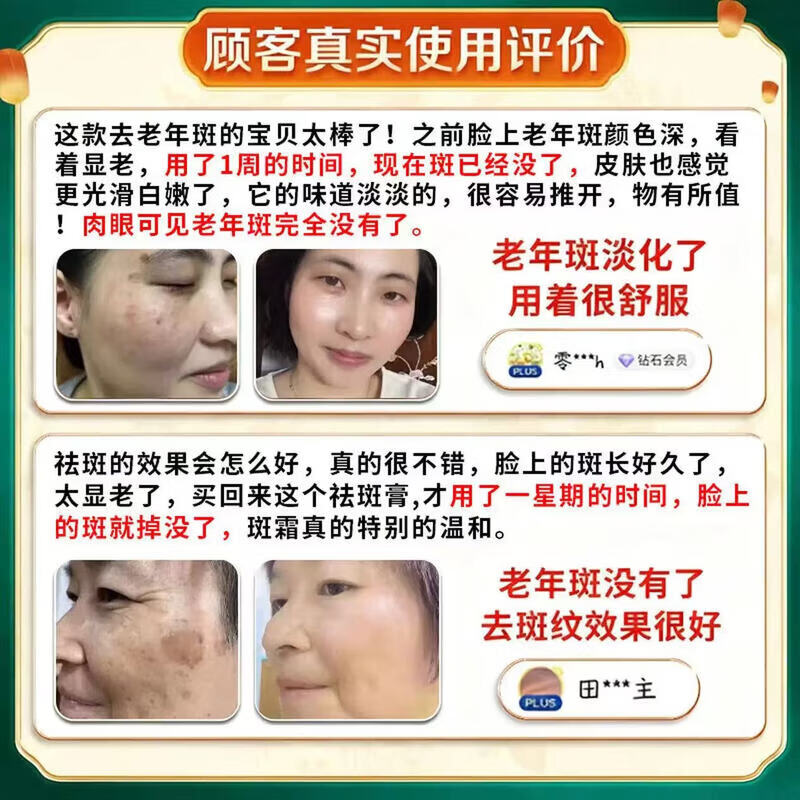 北京协和医学院祛斑霜老年斑专用特效非药一夜消去黄褐斑雀斑晒斑女士美i白用的 特效1盒【北京协和】祛斑点斑专用的药水医用级 白美淡化祛斑去黑色素黄褐雀斑晒斑男女士专用特效的药