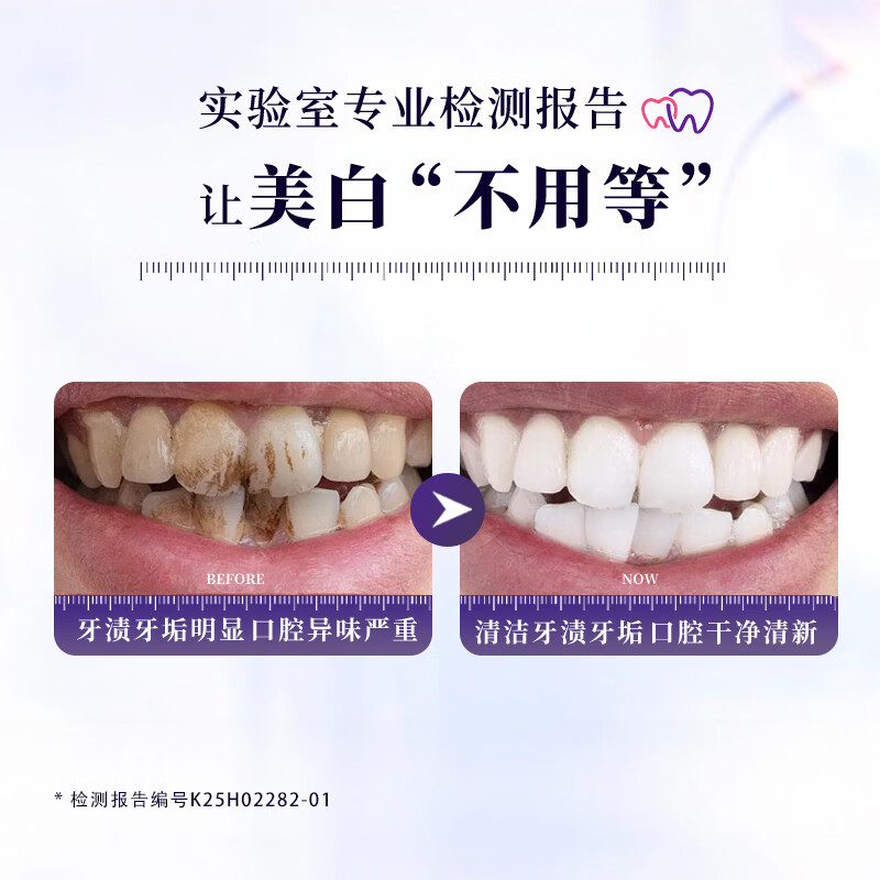 皓适舒美白牙膏去黄去渍去口臭去牙渍去烟渍牙垢官方旗舰正品2支装 玫瑰独白 200g