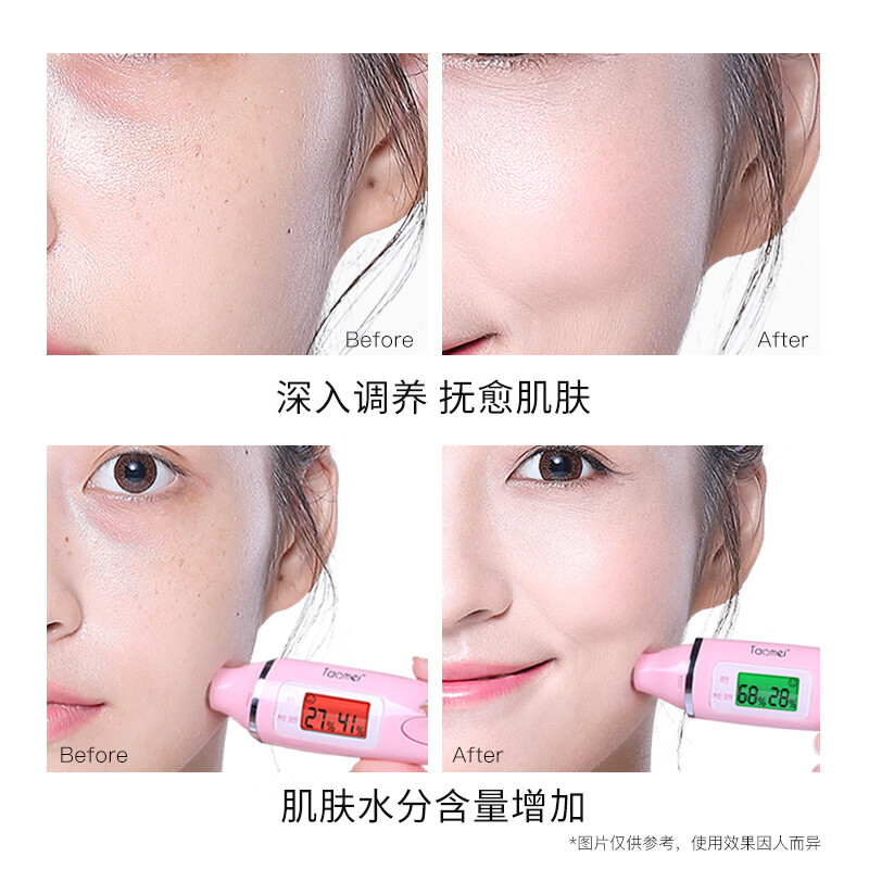 贝玲美（BEILINGMEI）热卖款贝玲美黄金贵妇奢宠九件套面部护肤品套装补水