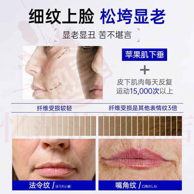 MRYU舒活宜凝胶祛法令纹颈纹医用硅酮凝胶提拉修护紧致肌肤官方旗舰店 5支装 官方自售