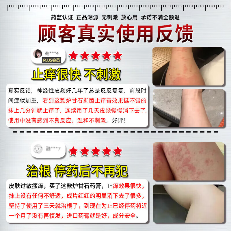 伊藤薬制日本炉甘石抑菌止痒皂全身瘙痒湿痒湿诊真菌感染止痒皂全身体适用 一盒【日本进口】炉甘石抑菌止痒膏 炉甘石软膏婴儿儿童止痒乳膏湿疹热疹