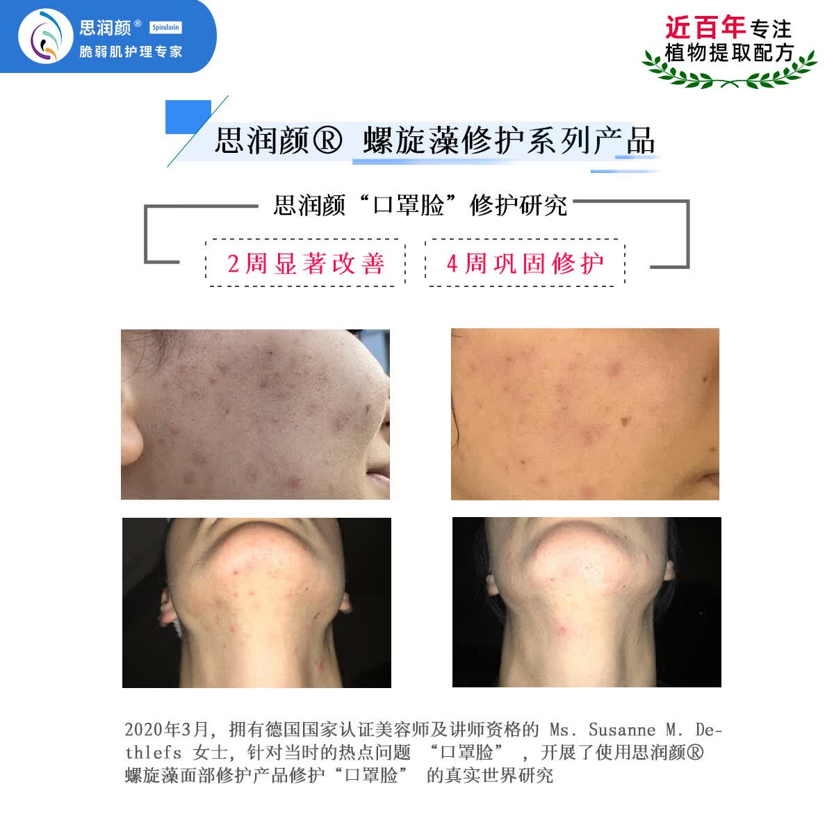 思润颜【临期清仓】修护霜德国药厂原装进口舒缓修护祛痘敏感肌30mL