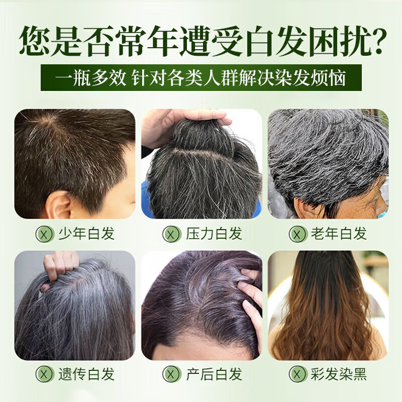 同仁堂100%染发膏纯天然植物无刺激不沾头皮染发剂一梳黑盖白发男女士孕 巧克力色1瓶 植物盖白