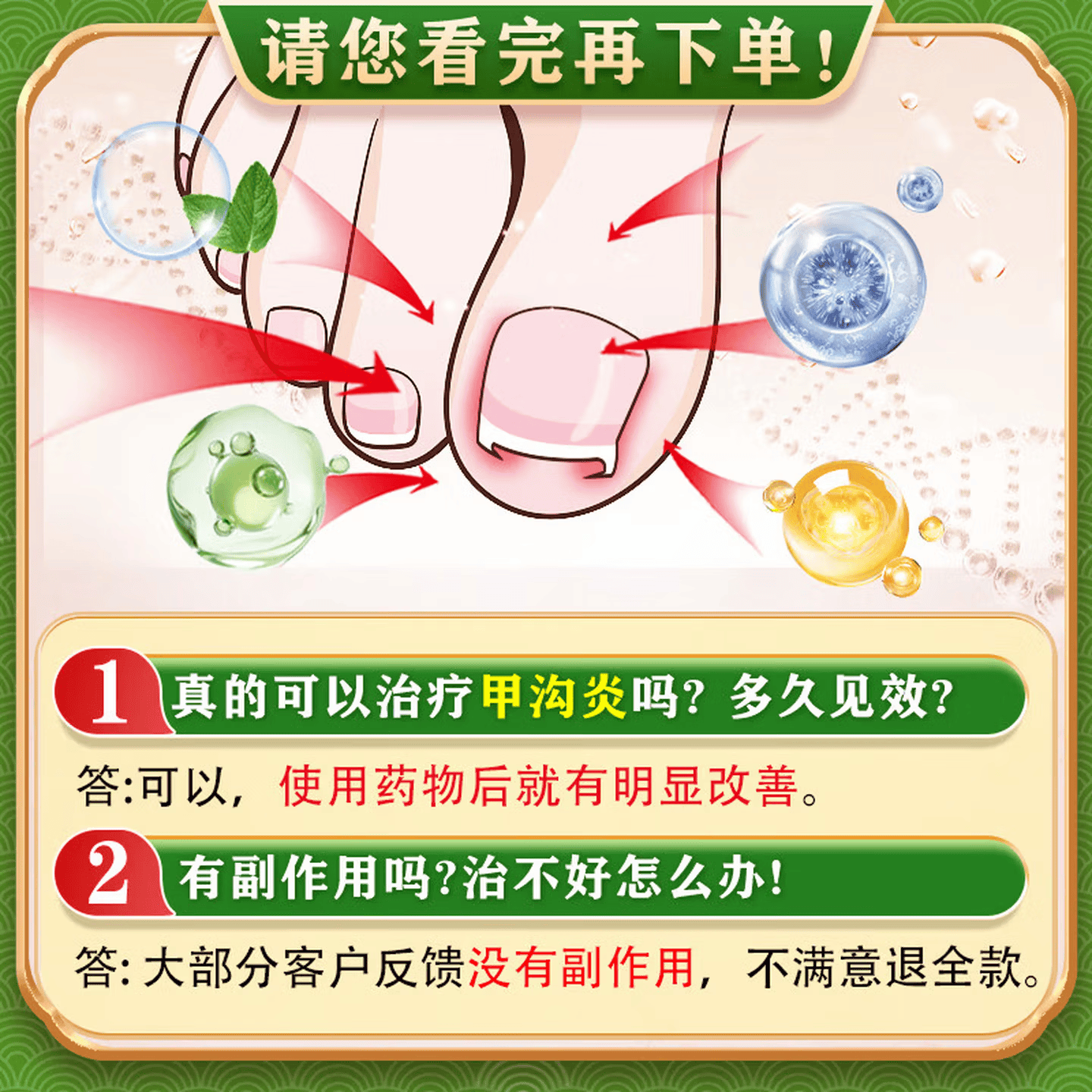 [华青]克霉唑乳膏 10g 1盒装 甲沟炎专用去药根部治脚趾甲往肉里长消肿止痛去肉芽治严重息肉外用消炎药【视觉特效】 +1盒溶液 消肿止痛 无需拔甲