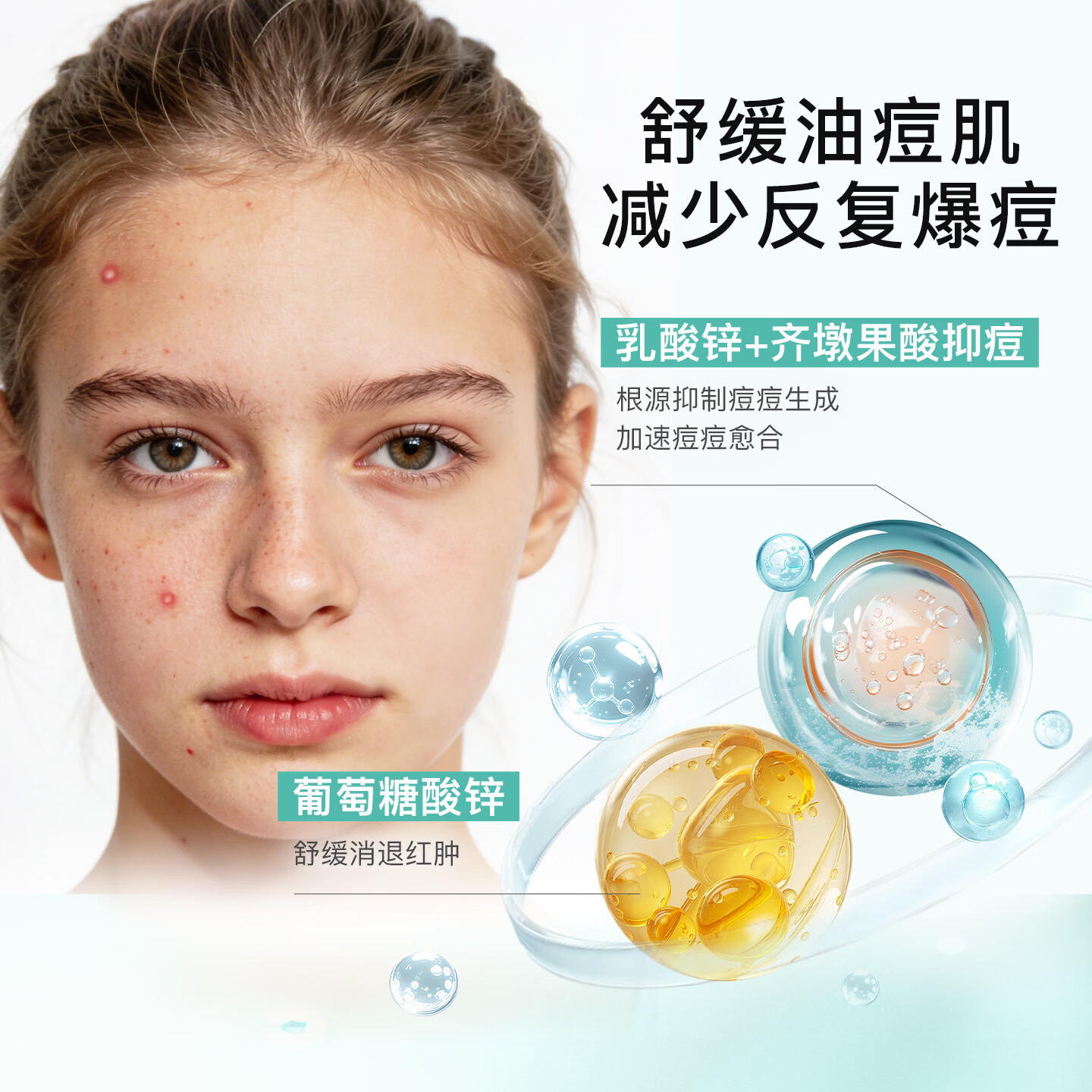 NOVEXPERT诺士博青少年专用洗面奶  祛痘去黑头控油青少年洗面奶30g 【祛痘洁面双子星】祛痘洁面30g+祛痘洁面150g