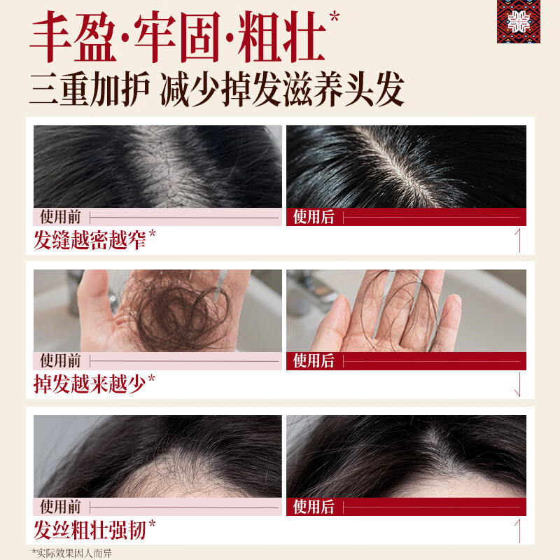 长发小寨【央视网同款】防脱育发液精华淘米水洗发水露固发控油男女 【防脱特证】非遗防脱精华液60ml