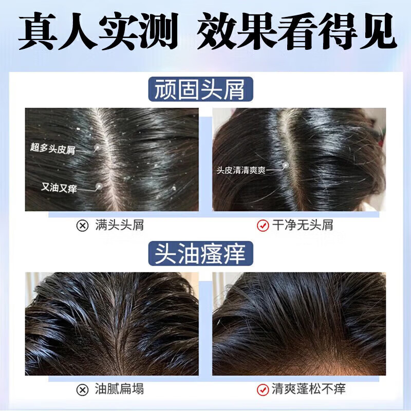 南京同仁堂二硫化硒洗发水去屑止痒控油持久蓬松毛洗发水金榜第1 二硫化硒洗发水3瓶特惠装