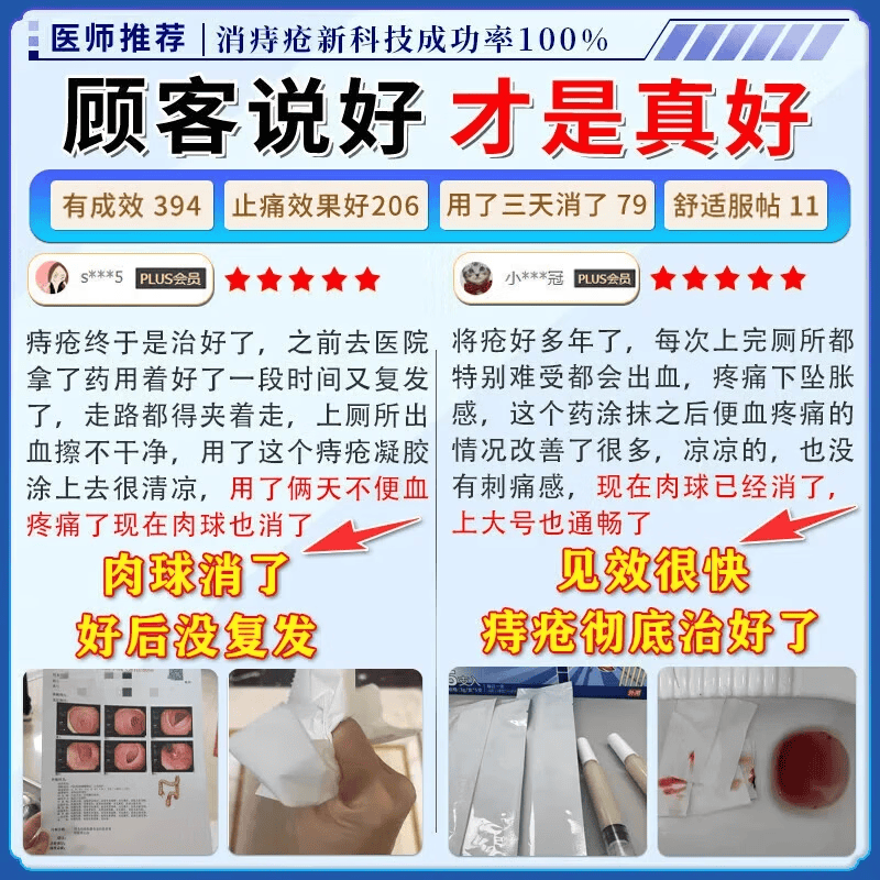 今古透痔疮膏 100%特效:5+4【已帮助2w+患者】 痔疮膏内外混合痔疮丨重度庤疮药膏消痔凝胶去肉球