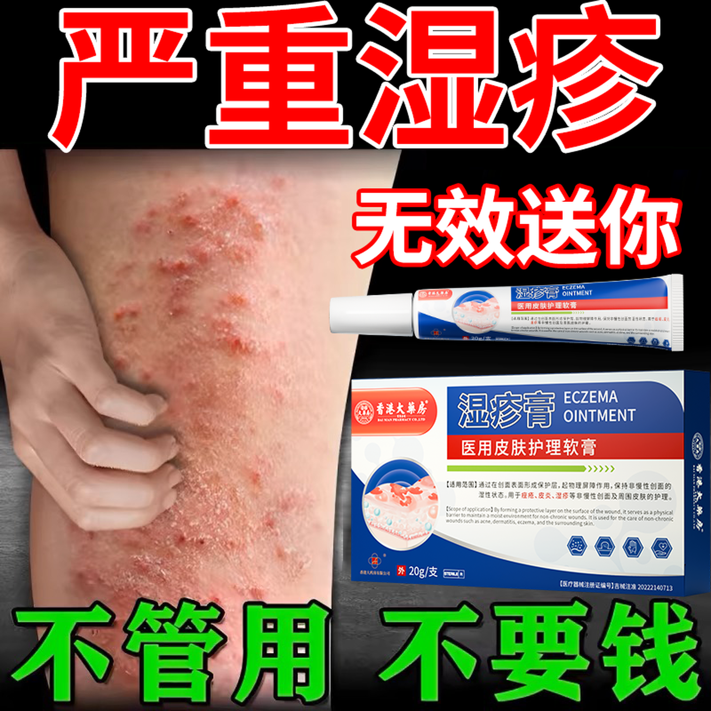 香港大药房湿疹膏搭湿疹药膏皮肤瘙痒皮炎湿疹真菌王感染止痒皮癣阴顽固湿毒 单盒【轻度湿疹】体验装