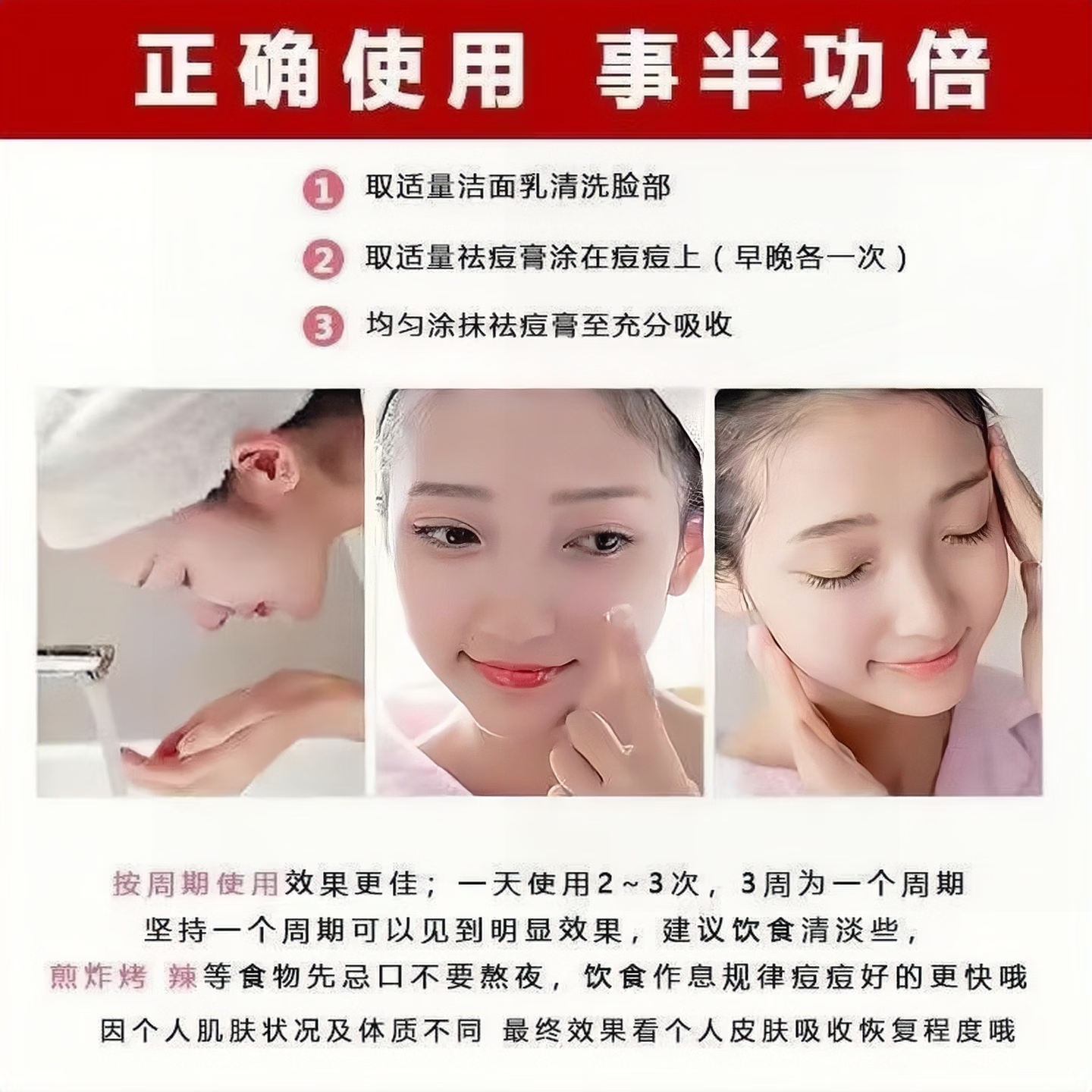 壬二酸15%祛痘凝胶温柔改善痘痘问题细致毛孔 四盒（巩固装）