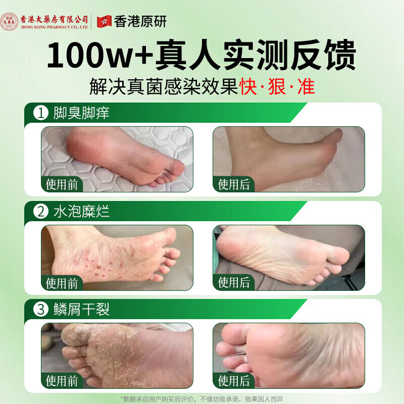 香港大药房有限公司真菌王皮肤瘙痒真菌感染私处抑菌阴囊潮湿大腿内侧肛门男女通用 1瓶【严重真菌感染】不划算