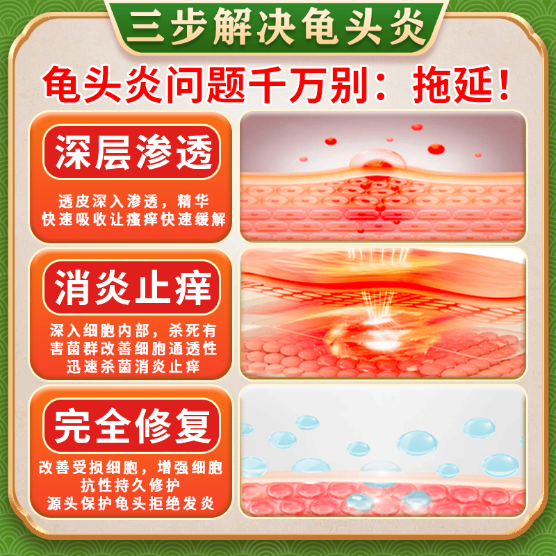[华青]克霉唑乳膏 10g 1盒装 软男性私处龟头发炎白垢豆腐渣专用药膏治真菌感染红肿念珠菌霉菌包皮异味京大东大药房 皮肤用药 非处方药