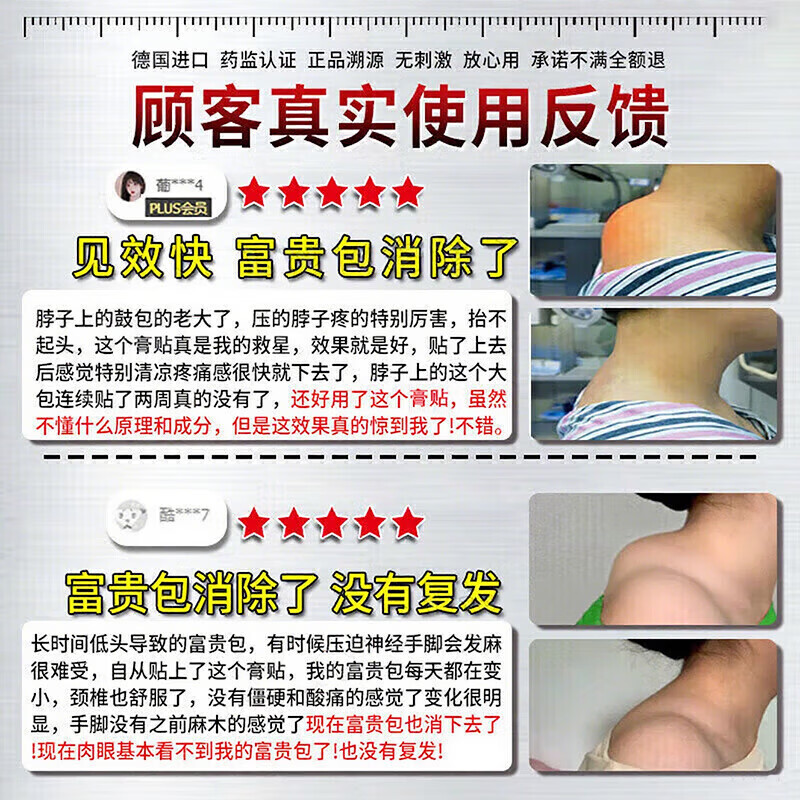 岩井昃弘富贵包消除贴颈椎疼痛治后颈鼓包专用疏通按摩矫正神器日本膏贴药 特效治【800%必冶好】 12贴*3盒 治疗富贵包日本原装进口膏贴