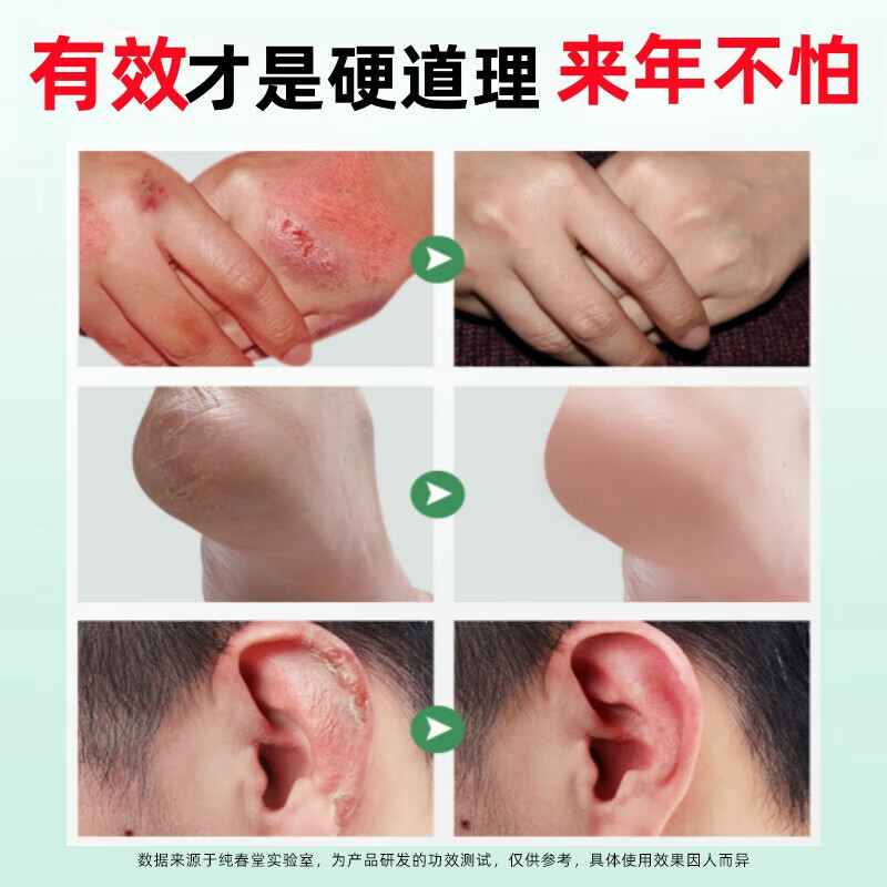 纯春堂冻疮膏手足防裂膏脚裂手裂脚后跟干裂龟裂开裂皲裂膏滋润保湿 【重磅升级】冻可宁50g