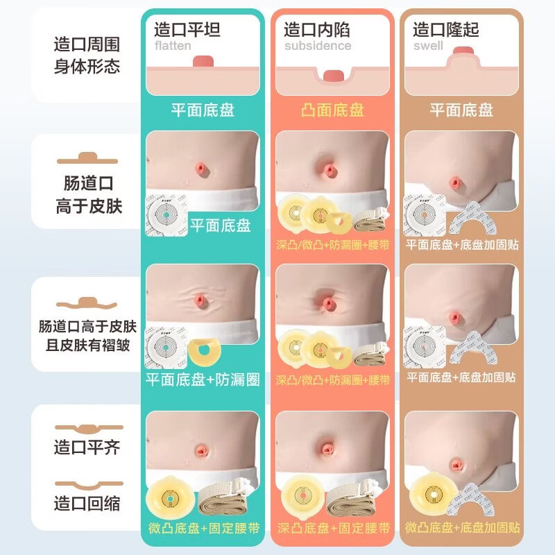 护士同学造口袋二件式可排气碳片除味10386康L保两件式医用一次性造瘘袋 【同康L保10386】5个袋子【适配康L保底盘】