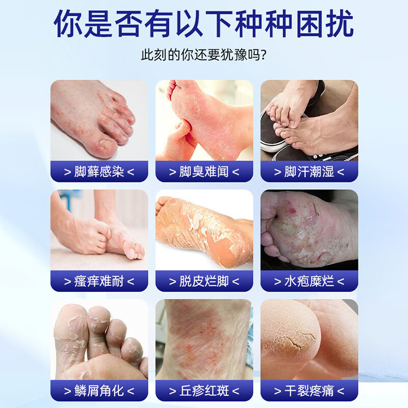 通用丈医生 百草奇痒王+喷脚王乳膏叮咬皮肤瘙痒止痒膏 【喷脚王30ml+百草奇痒王20g】1套装