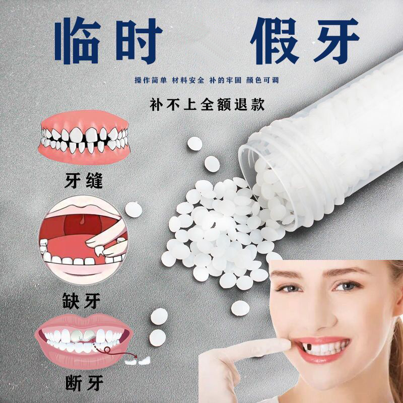 戬珏自己补牙自制临时假牙齿树脂材料临时自缝牙洞窟窿填充仿护齿
