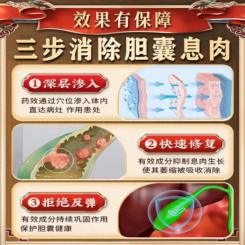 久研制药胆结石排石药胆囊结石进口的药胆囊息肉日本消石素专用胆囊炎膏药 日本研发结石贴【1盒12贴】 胆结石排石胆囊结石进口的药