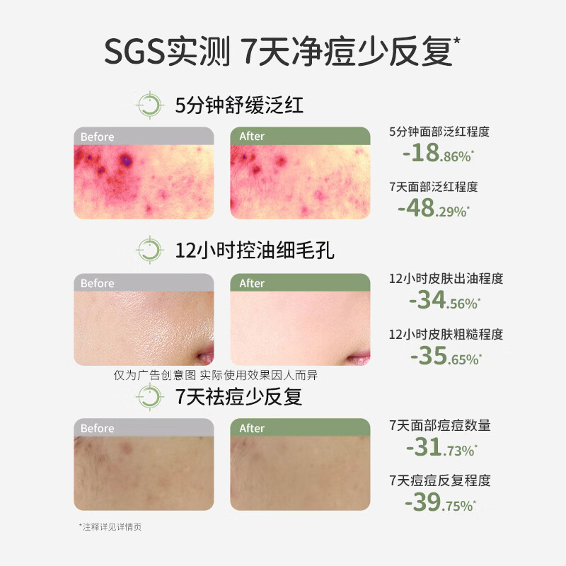 袋鼠妈妈洗面奶 男女孩氨基酸洁面乳学生 青少年护肤三件套爽肤水修复乳 三件套【洁面乳+爽肤水+清透乳】