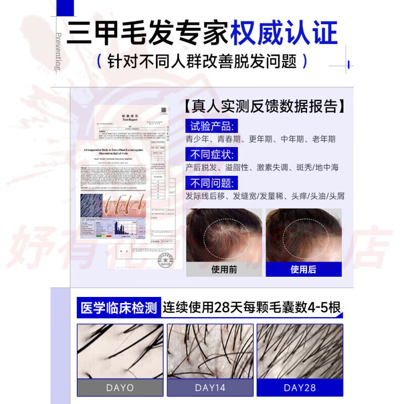 熏姿颜玉匠坊洗发水防脱防断育发固发养发强韧发根滋养头皮控油蓬松去屑 1瓶周期装【防脱养发】 官方自售