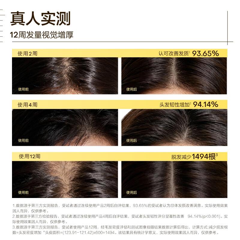 极方【徐璐推荐】防脱洗发水控油蓬松丰盈强韧固发果香调男女洗发水 防脱控油洗护300ml+300ml