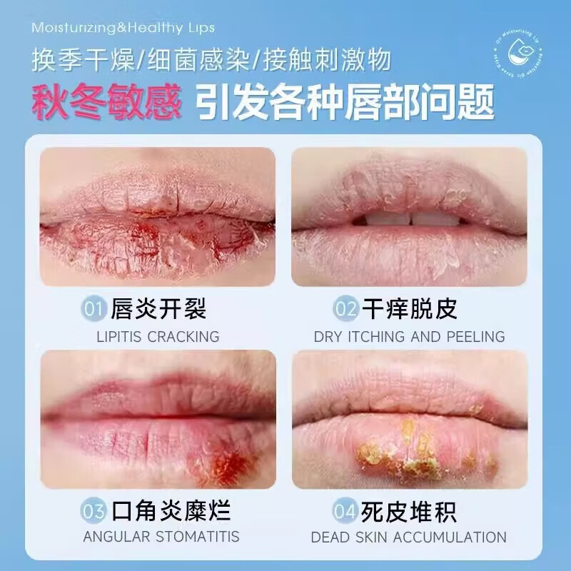 三草油北京唇膏三草油冬季学生在校冬季男女通用唇炎口裂唇膏儿童 单盒装【滋润保湿】