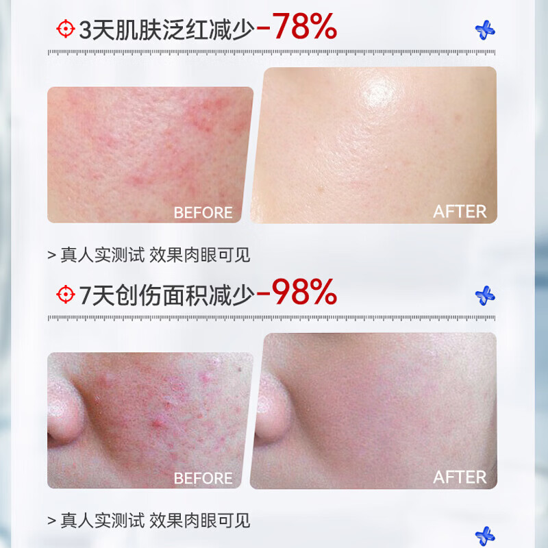 盛姿颖重组Ⅲ型胶原蛋白修护贴肌肤屏障注胶原深修护创面舒缓修护面膜 修护贴4盒20片装