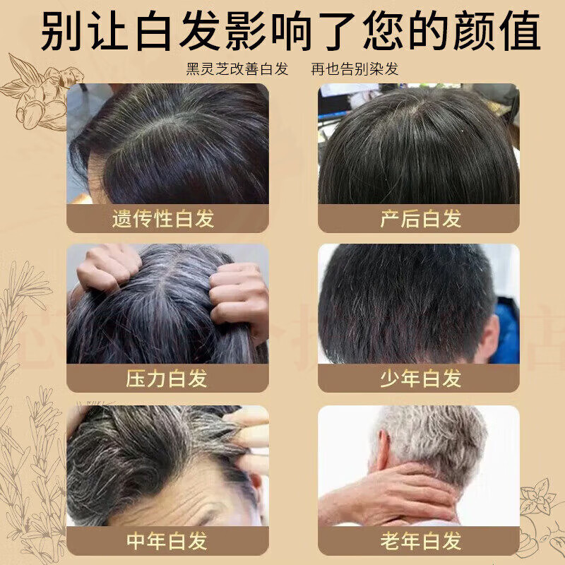 思亚希禾源颂正品白发转自然黑洗发水头发自然黑改善掉发控油蓬松去屑 1瓶轻度白发适用 官方直售