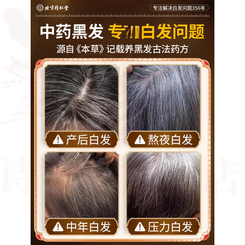 MRYU禾源颂白发转自然黑洗发水官方旗舰店乌发改善掉发控油蓬松去屑 3瓶装【中度适用】 官方自售