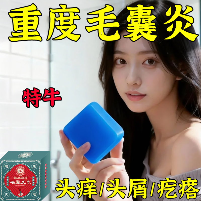【香港药房】毛炎宁洗发皂净炎净澈修护毛囊去屑止痒除螨虫控油皂 买1发3【头螨/头痒/头屑】