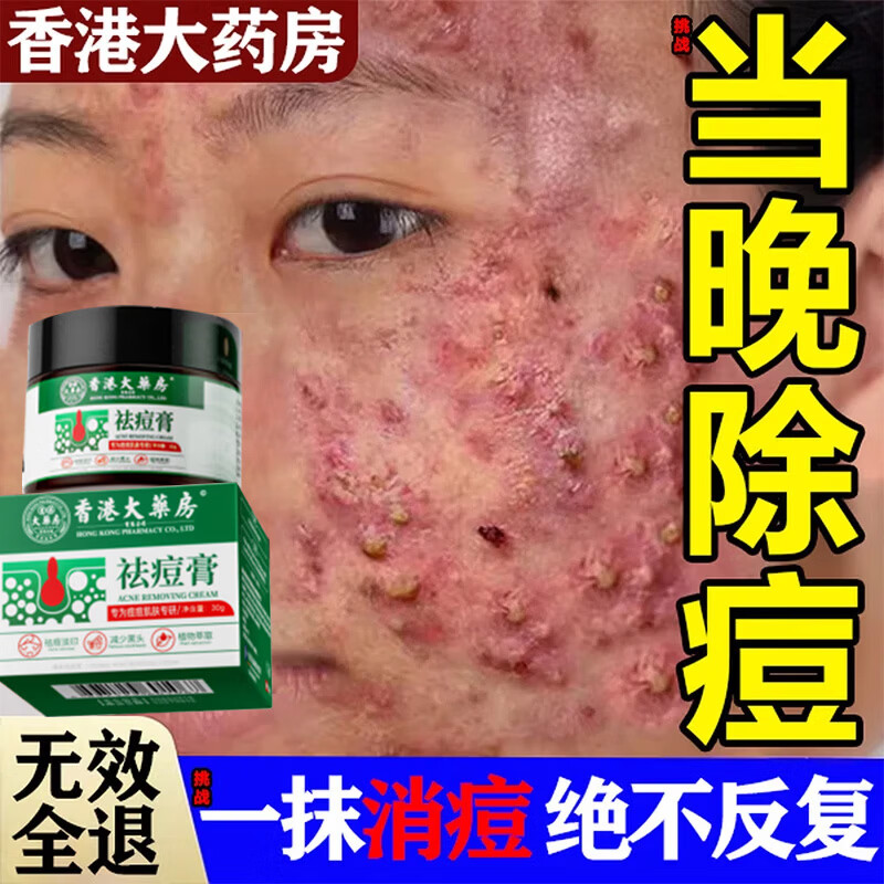 香港大药房祛痘膏和痘印坑修复痘痘和痘印青春痘消炎痤疮粉刺专用学生青少年 1瓶【买2送1】