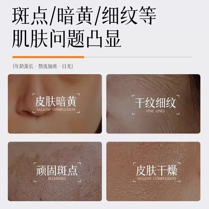 DT【控色水乳】美白祛斑倍护精华水乳淡化斑点提亮肤色伊华祛斑产品 【官方正品】美白祛斑精华水*1+试用装