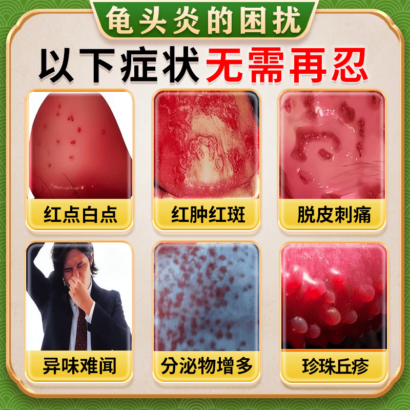 [华青]克霉唑乳膏 10g 1盒装 软男性私处龟头发炎白垢豆腐渣专用药膏治真菌感染红肿念珠菌霉菌包皮异味京大东大药房 皮肤用药 非处方药