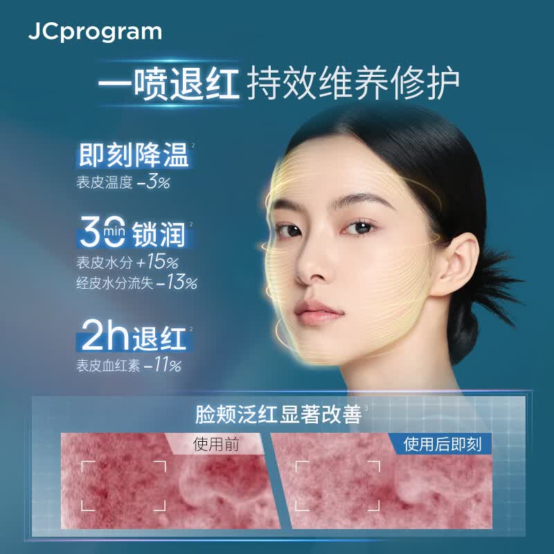 自由之丘调护精华喷雾75ml密集补水舒缓肌肤泛红干皮保湿敏感肌护肤品礼物 舒缓修护精华喷雾75ml【2.0版本】
