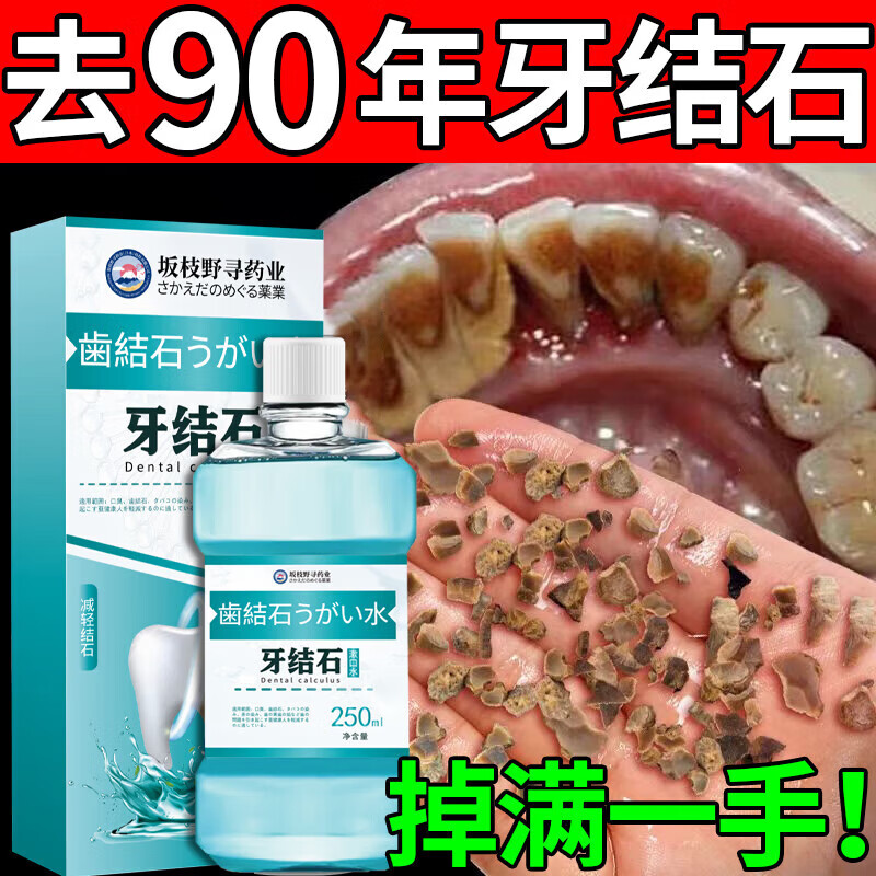 坂枝野寻漱口水便携牙结石口臭去黄牙石牙垢牙周膏炎牙渍速傚溶解清新口气 告别牙结石口臭】1瓶