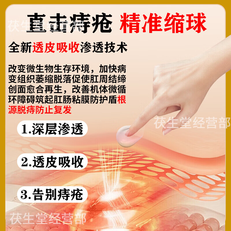 华佗痔疮膏凝胶100%重度痔疮去i肉球内外混合痔疮专用痔根i断痔膏药 100%特效：5盒【肉球便血疗程装】重度疮药