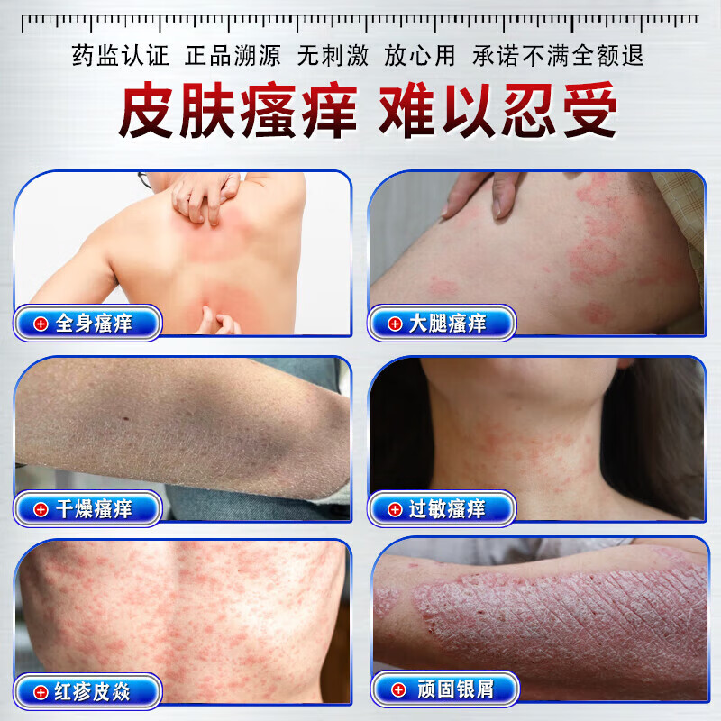 伊藤薬制日本炉甘石抑菌止痒皂全身瘙痒湿痒湿诊真菌感染止痒皂全身体适用 一盒【日本进口】炉甘石抑菌止痒膏 炉甘石软膏婴儿儿童止痒乳膏湿疹热疹