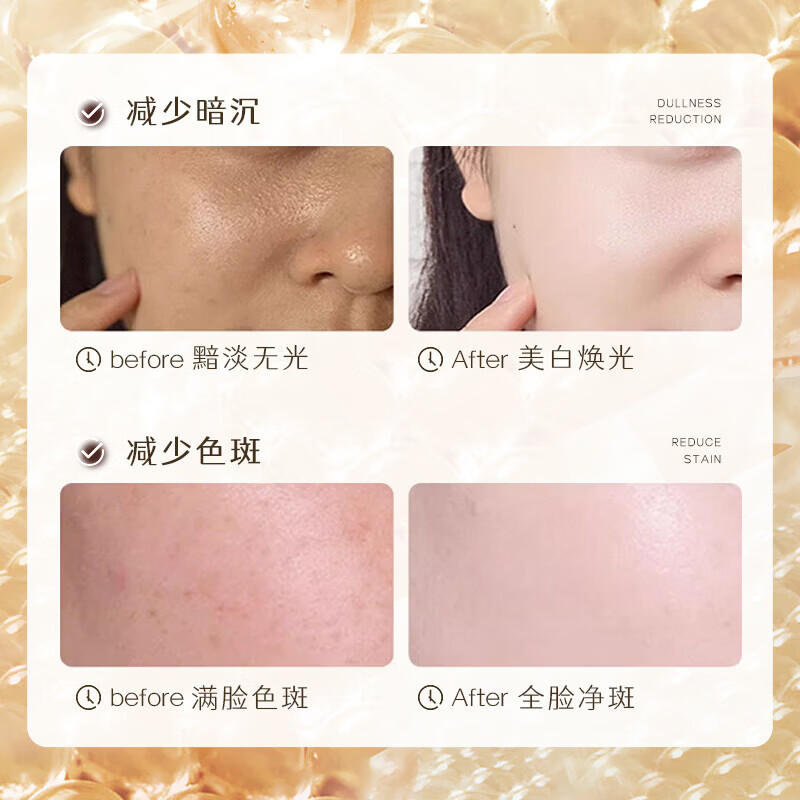 冬禾【旗舰授权】冬禾祛斑精华液水乳套装提亮肤色烟酰胺美白护肤品 冬禾祛斑精华液30g*1支